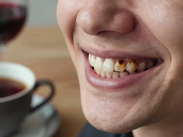 Co nejvíce barví zuby? Nejčastější příčiny tmavých zubů a jak jim předcházet