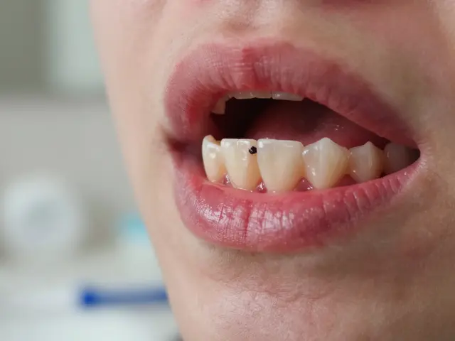 Jak se zbavit zánětu v puse: praktické kroky a co dělat, když to nechce ustoupit