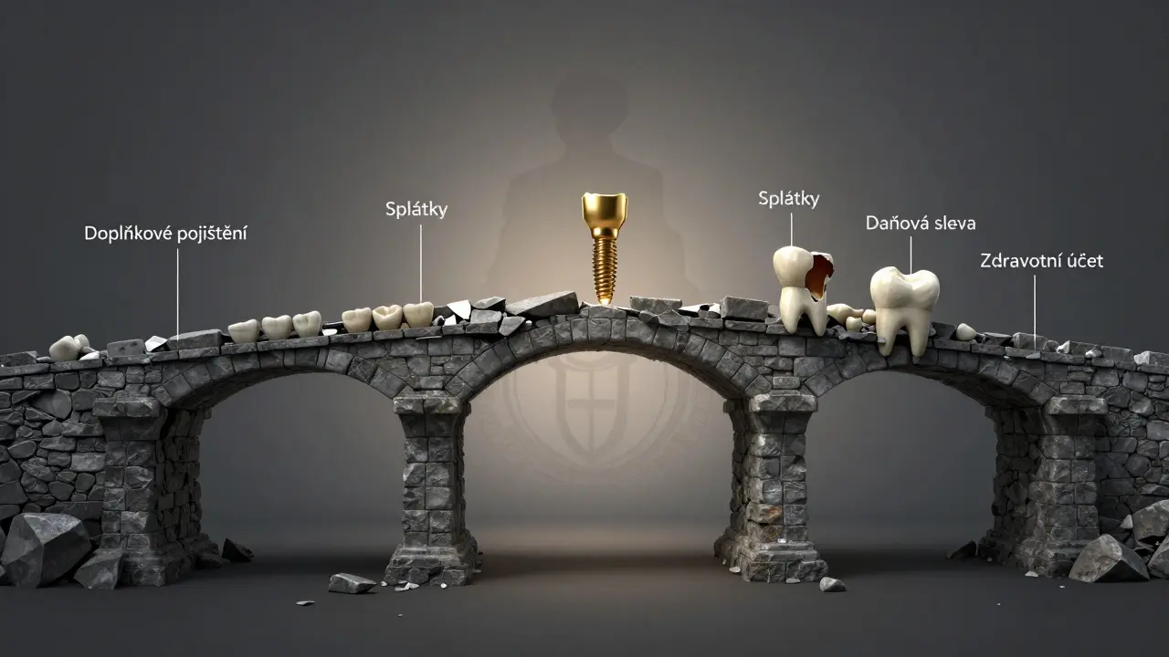 Kostní most s chybějícím zubem, který nahrazuje zlatý implantát podporovaný finančními nástroji.