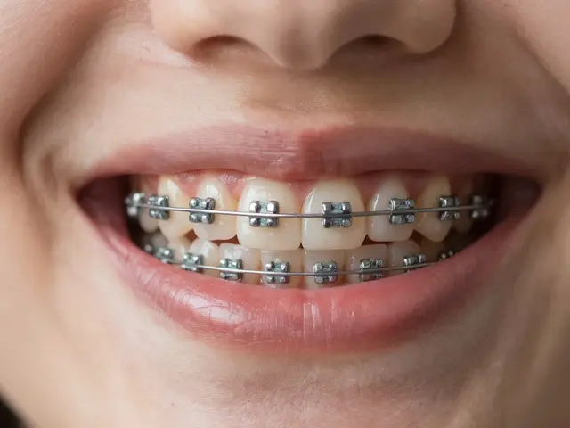 Keramická rovnátka: Úplný průvodce pro začátečníky