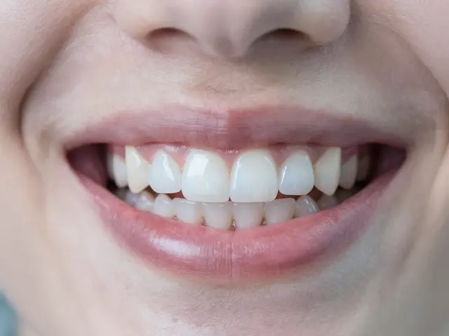 Broušení zubů: Kolik to stojí a vyplatí se vám to?