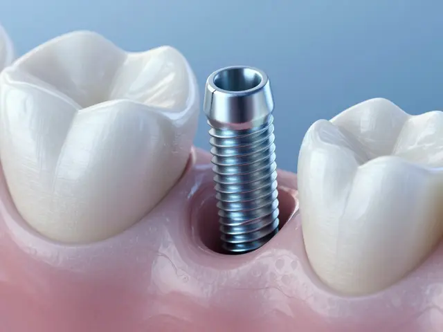 Jak dlouho trvá nasazení korunky na implantát? Kompletní průvodce procesem