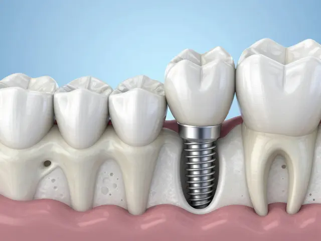 Jak zubní implantáty přispívají k lepšímu fyzickému zdraví: Komplexní průvodce