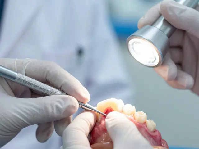Co je kyretáž zubů? Kompletní průvodce po proceduře, bolestivosti a cenou