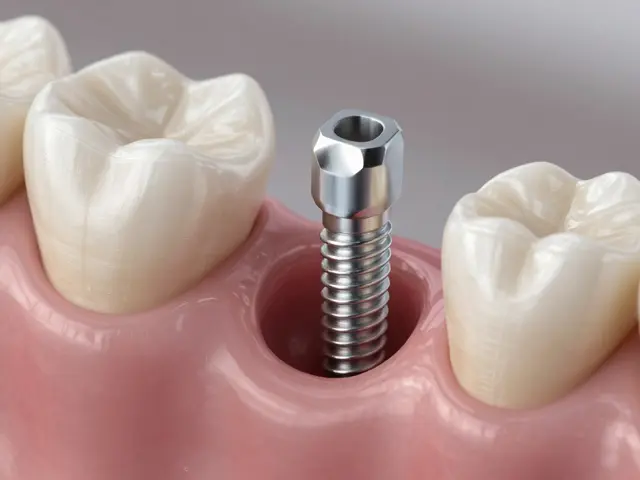 Zubní implantáty: Proč jsou nejlepším řešením pro chybějící zuby